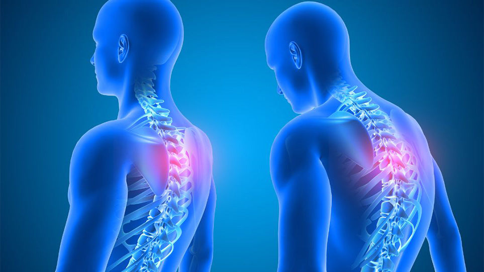 How Posture Affects Your Joint Health & Simple Fixes